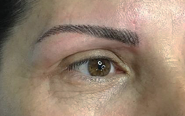 Reconstrucción de cejas al instante 