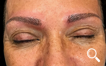 Caso real de micropigmentación pelo a pelo. Maquillaje permanente de cejas. 